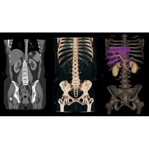 КТ аппарат GE Revolution CT